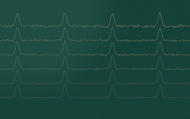 Αφηρημένο εικαστικό: ακανόνιστος παλμός που βρίσκει ρυθμό